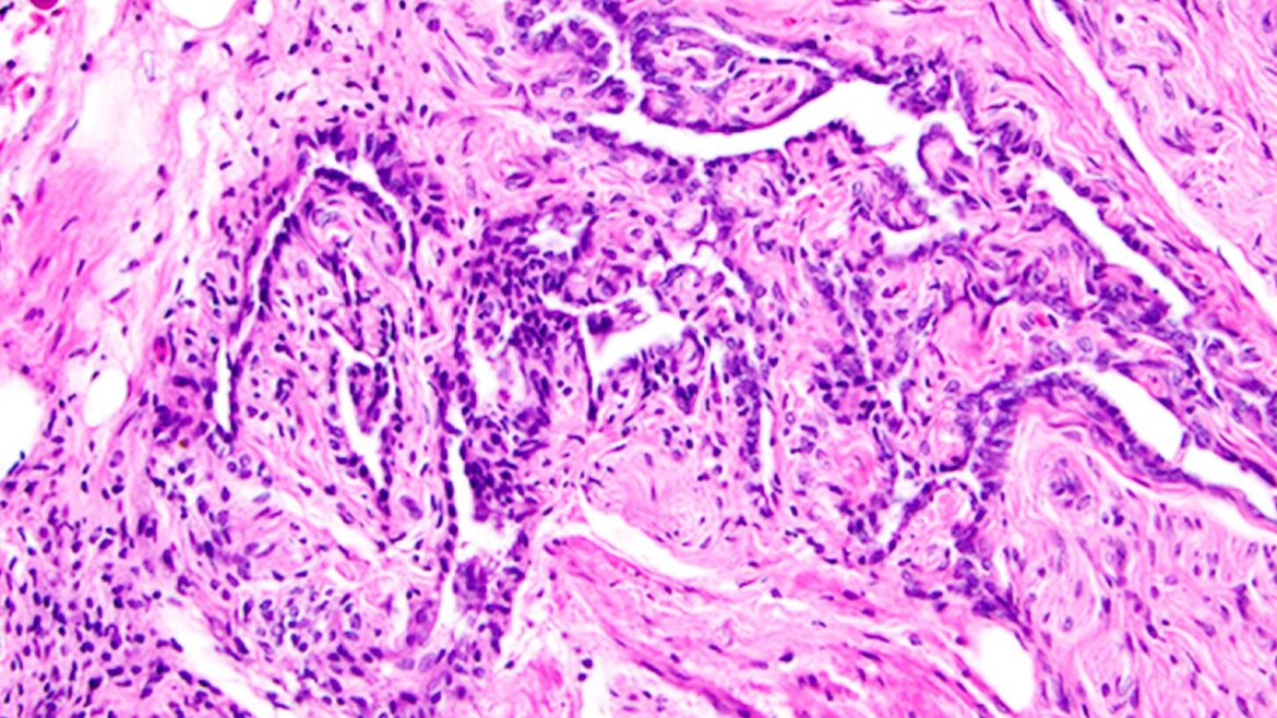 A microscope image of the tissue in the rete ovarii
